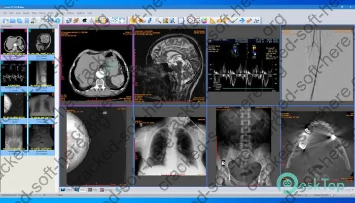 Sante DICOM Editor Crack 10.0.8 Free Download